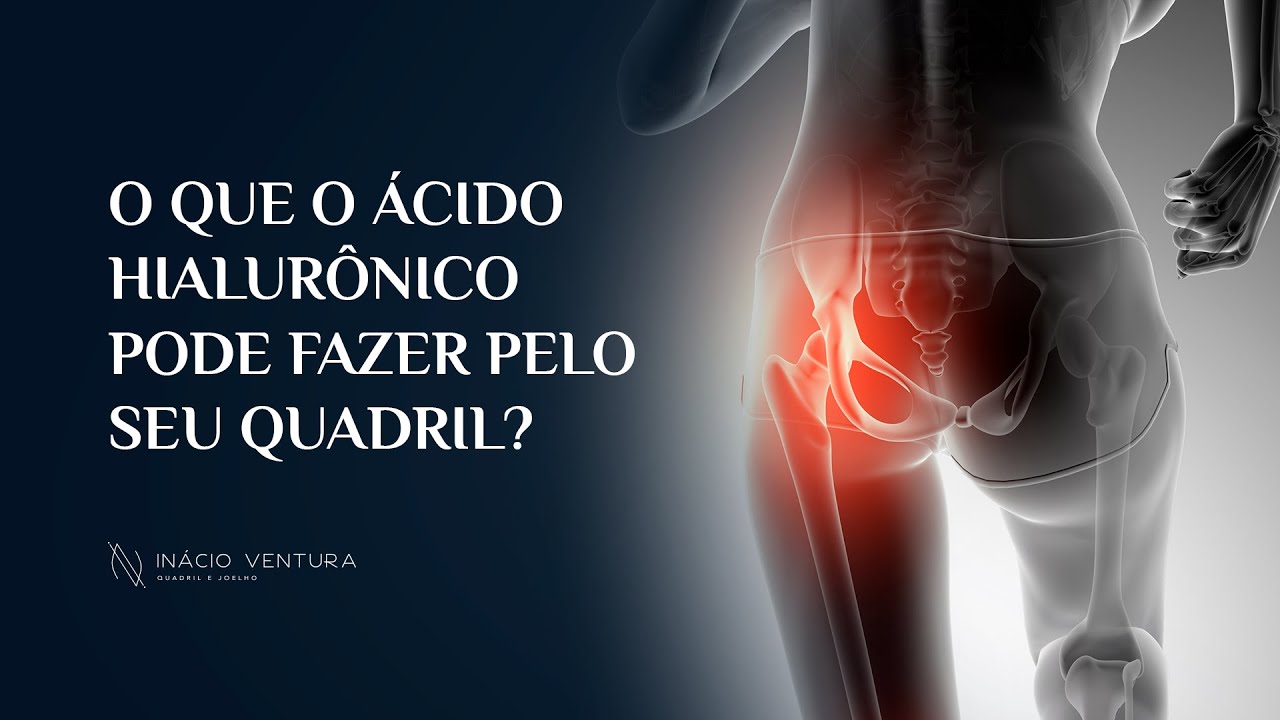 O que o Ácido Hialurônico pode fazer pelo seu quadril? | Dr. Inácio Ventura