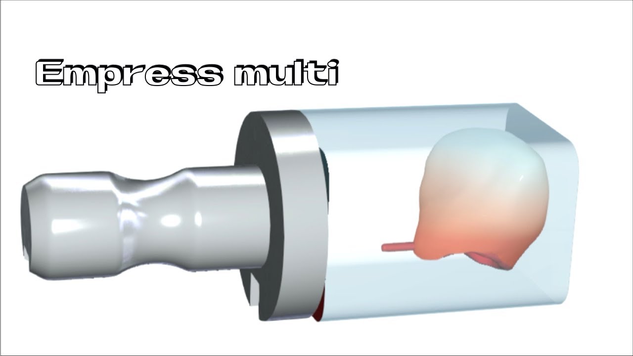 CAD/CAM restoration production using Empress Multi【歯科用ブロック.エンプレスマルチA3.5を使用した修復物】