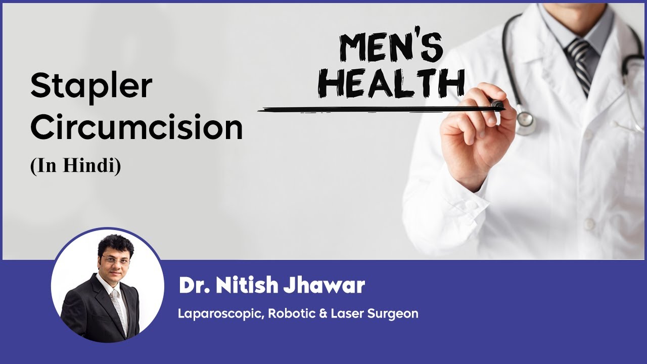 Stapler Circumcision, its Advantages and Benefits (in Hindi) | ZSR Cicumcision | Dr Nitish Jhawar