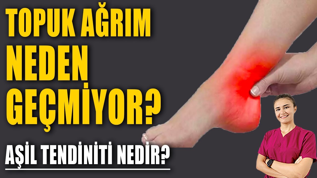 AŞİL TENDİNİTİ NEDİR? TEDAVİSİ? #aktifizyo #kulunçağrısı #fiziktedavi #topuk