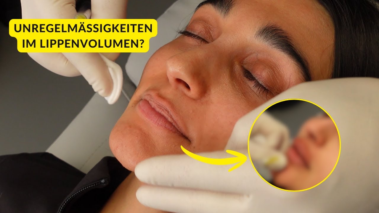 Volle, aber natürliche Lippen? Moderne Lippenbehandlung – echte Behandlung bei LIVION