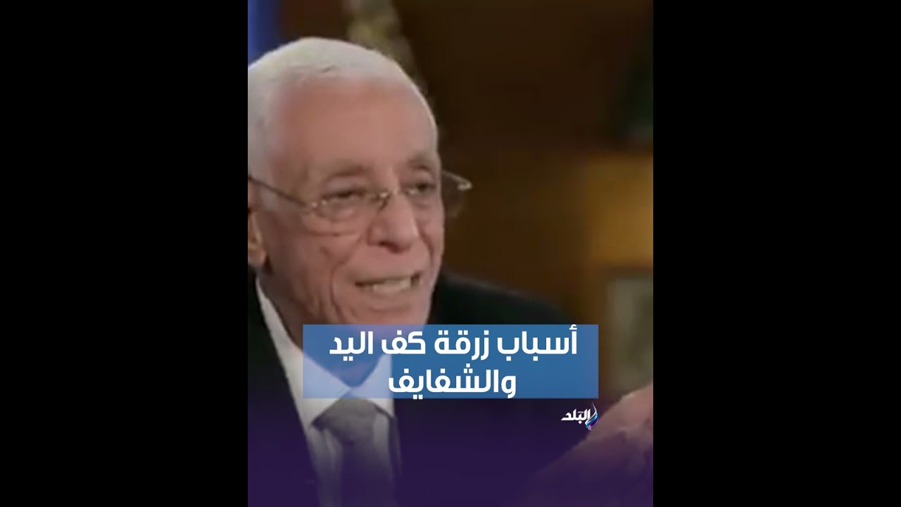 هل زرقة كف اليد تشير لمشكلة خطيرة؟.. الدكتور حسام موافي يكشف السبب