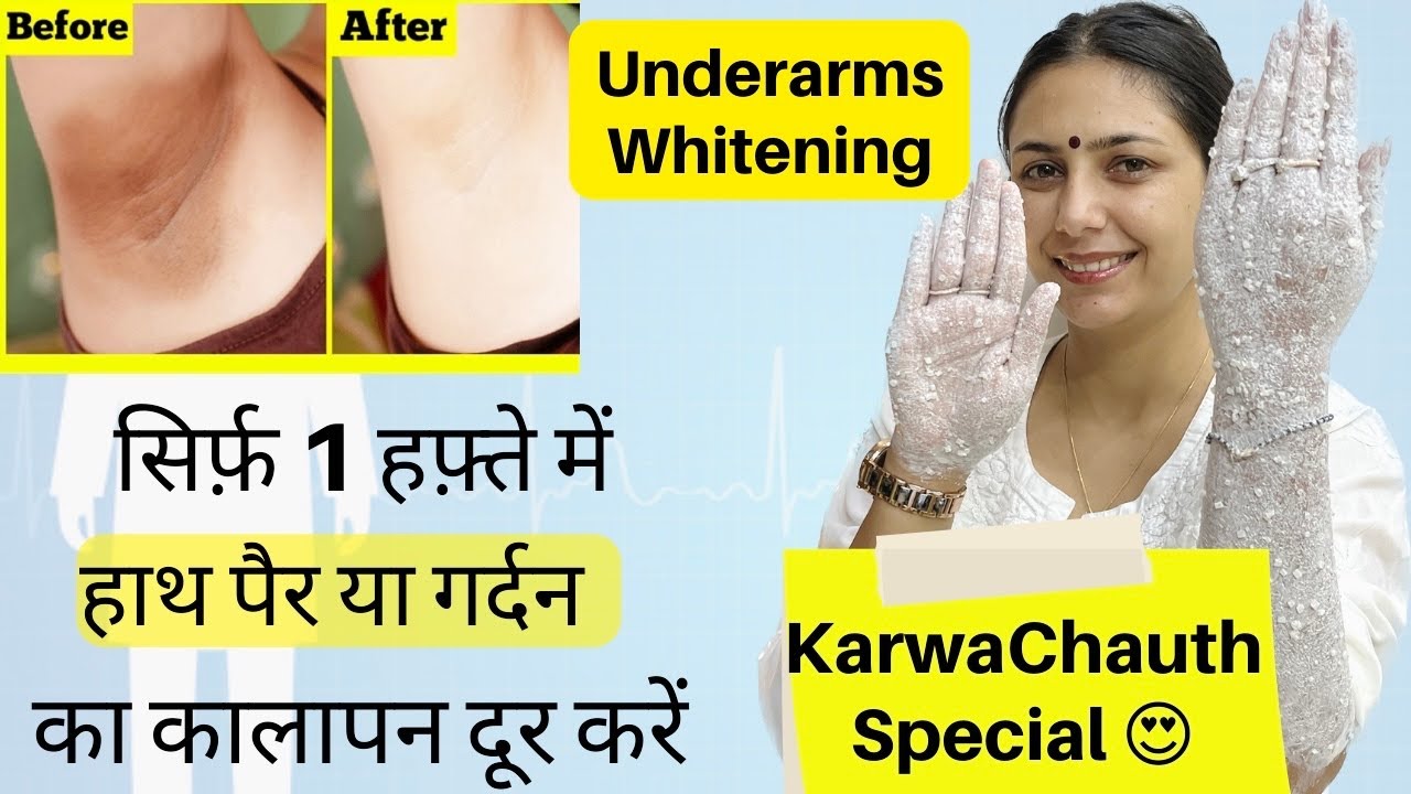 Karwachauth Special Skin Whitening Home Remedy | Underarms Whitening Remedy | Dr. Upasana Vohra