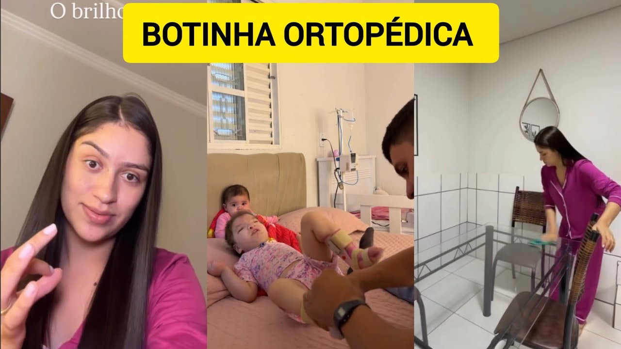 ANA VITÓRIA COLOCOU A BOTINHA ORTOPÉDICA NA HADASSA 