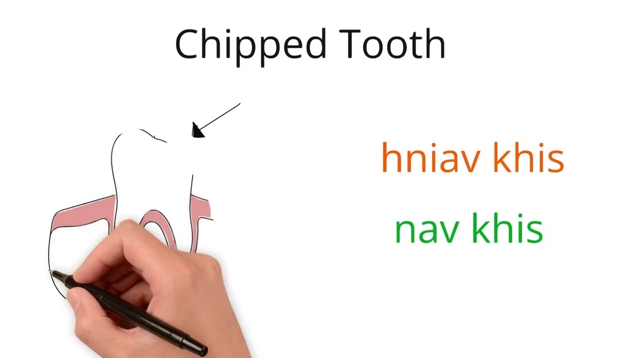 Common Dental Terms in Hmong Part 2  #hmong #medical #terminology