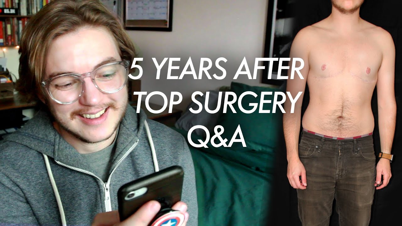 What If You Don't Like Your Results? | 5 Years Post-Top Surgery Q&A