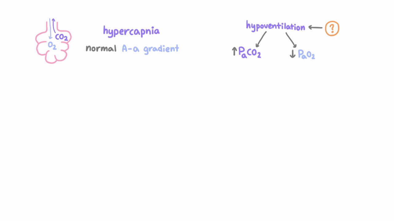 Hypoventilation
