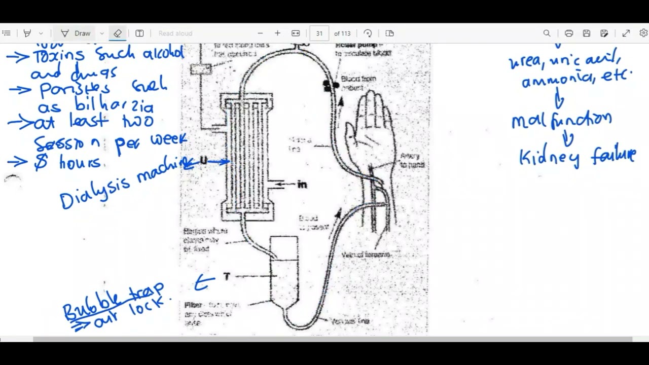 HOW TO ANSWER QUESTIONS ON KIDNEY MACHINE(EXAM QUESTION)