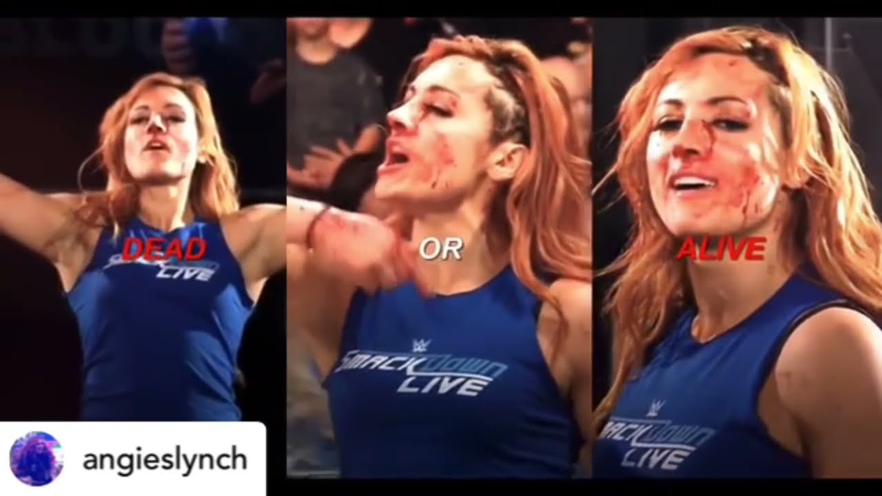Best Becky Lynch Edits Pt 5
