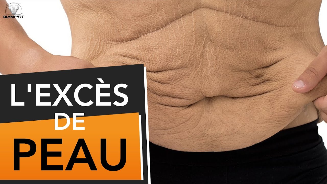 Excès de peau après une perte de poids, causes et solutions (peau flasque détendue)
