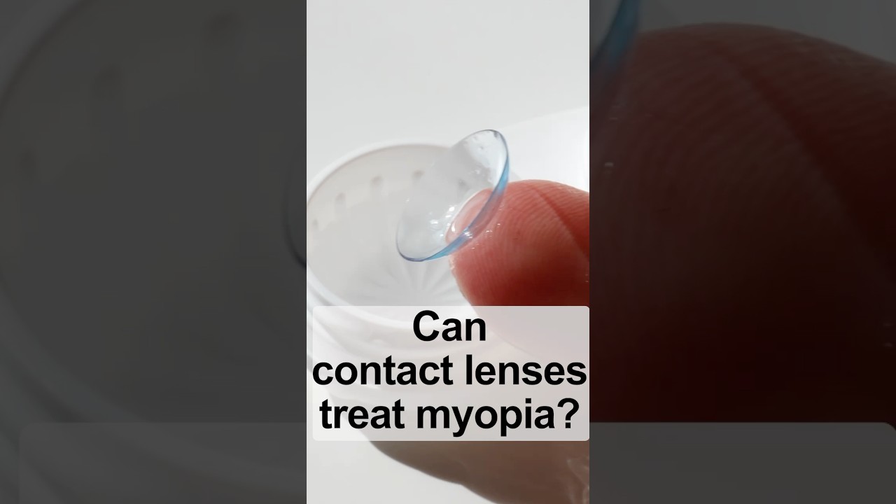 Can contact lenses treat myopia?