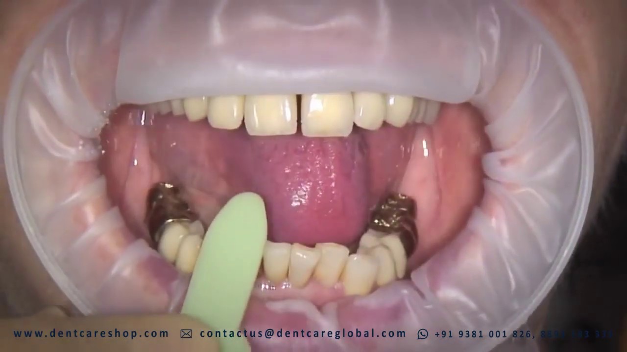 Fleximeter Strips - Bausch - Care for Perfect Occlusion from dentcareshop.com