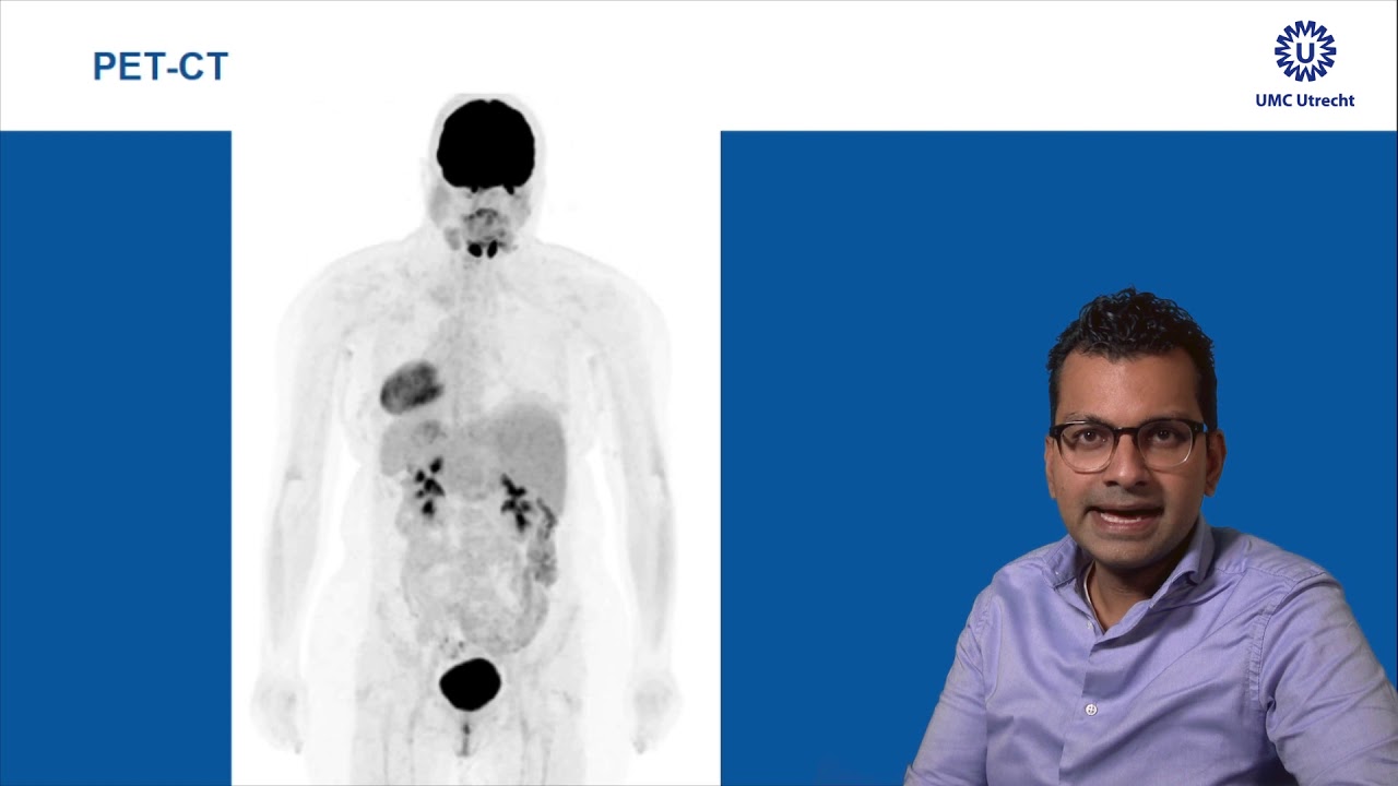 Radiologie en longkanker - informatie voor patienten