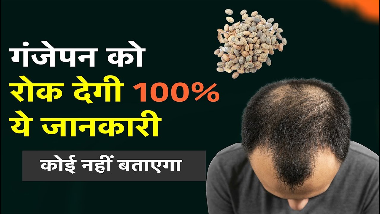 3 reasons behind Hair Fall ✅ Dr Prateek Chauhan