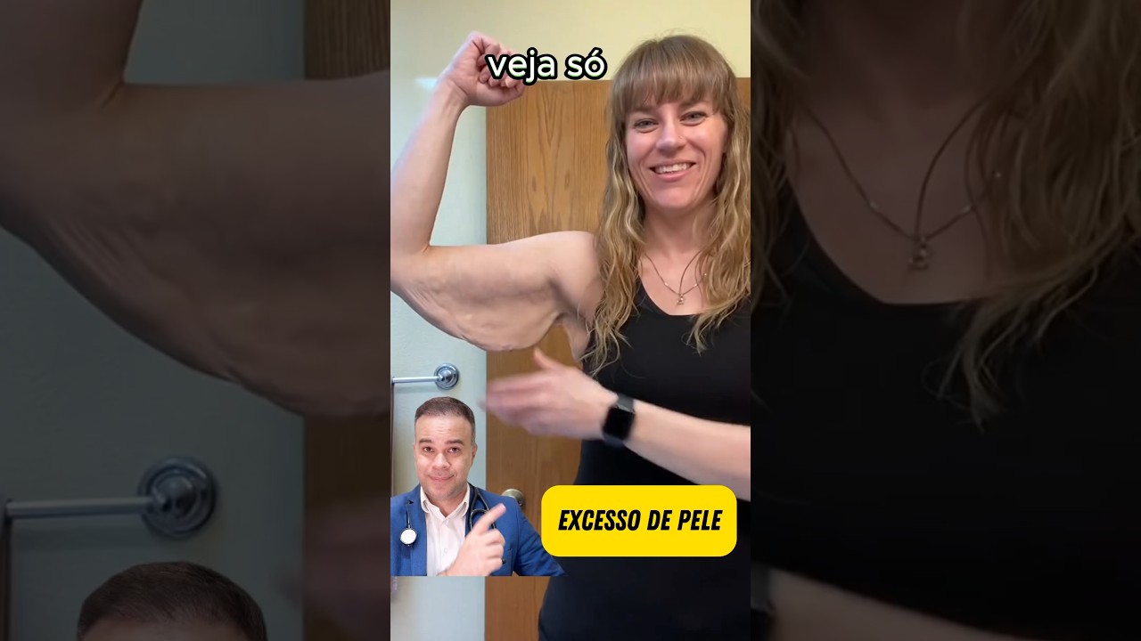 Era s&oacute; PELANCA !