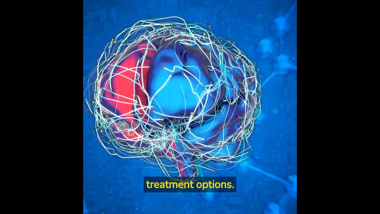 Artificial Intelligence and Mental Health | The Brainwave Chronicles