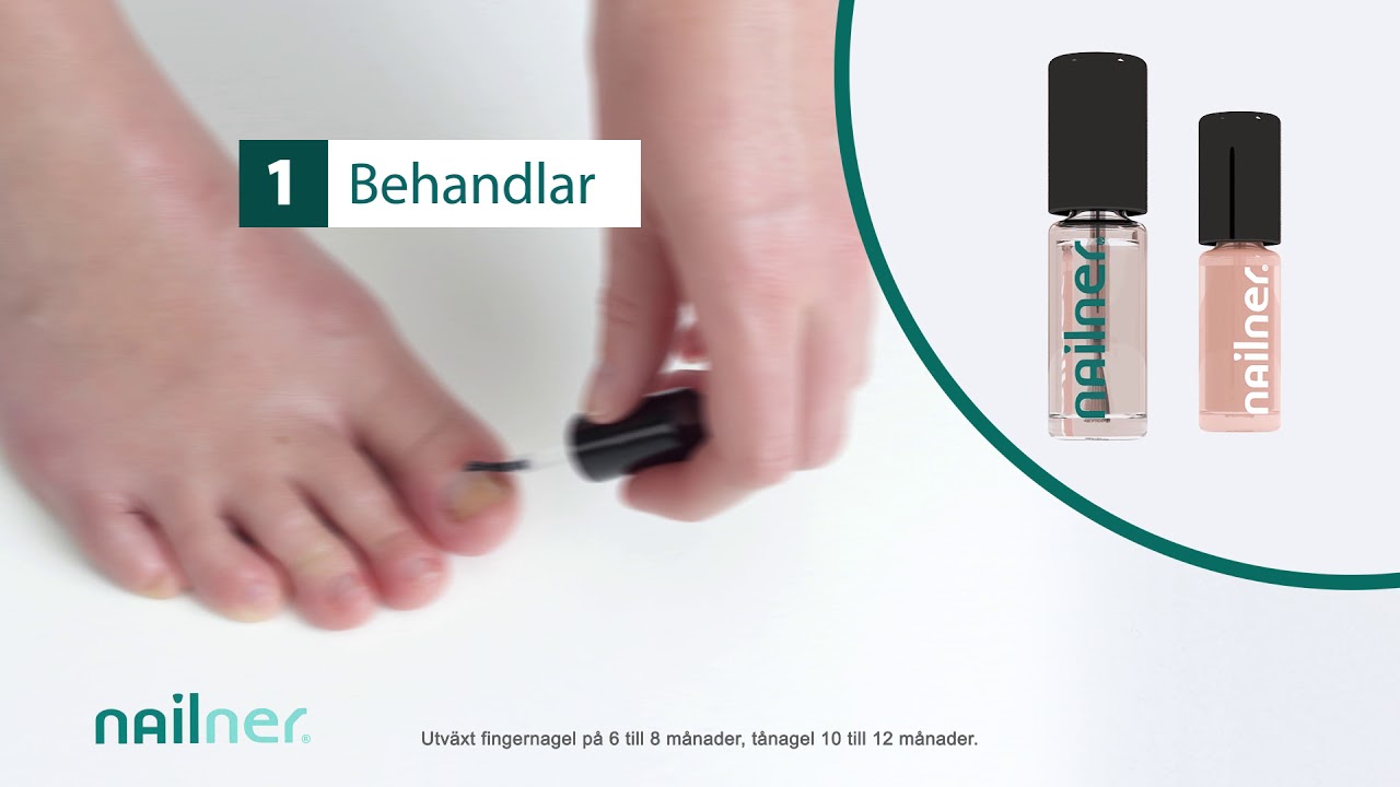 Nailner Behandla & F&auml;rga - Bevisat effektiv mot nagelsvamp
