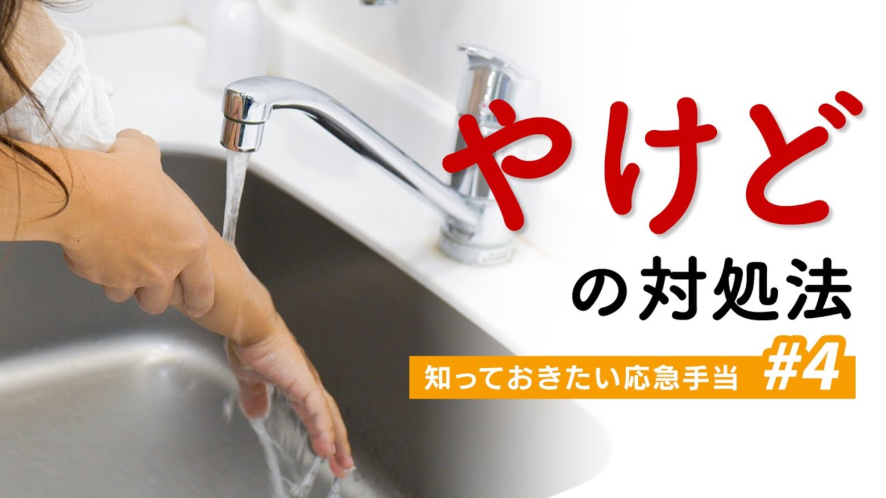 子どもがやけどしたらどうする？ 知っておきたい「やけど」の対処法【知っておきたい応急手当 #4】