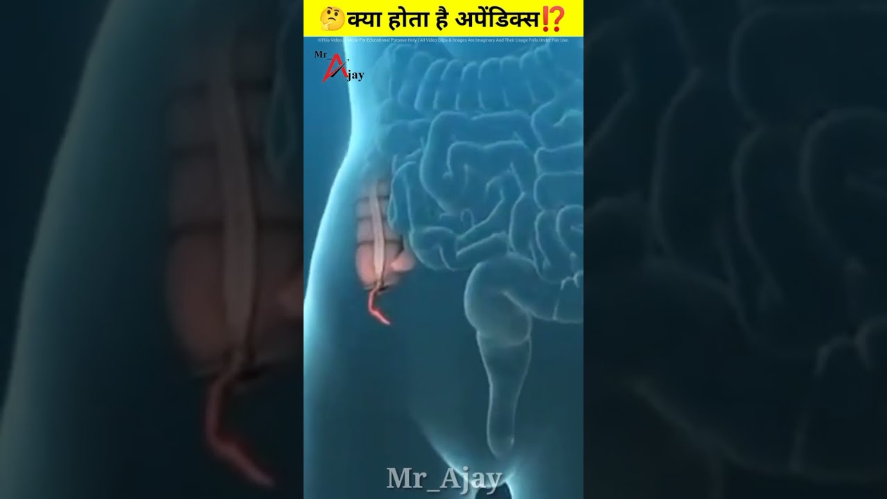 क्या होता है अपेंडिक्स ?शरीर में इसकी ज़रूरत क्या है?#shorts