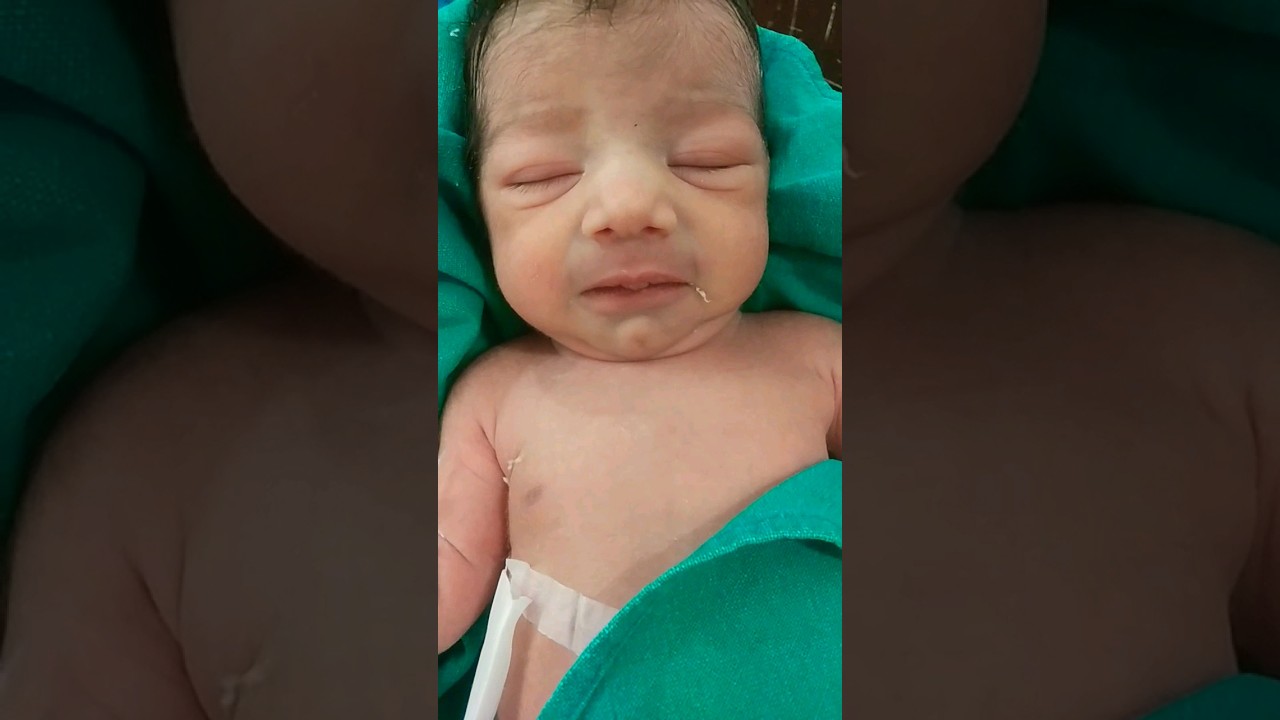 Icu Baby Care❤#baby #emergency #icu #babycare #hospital #newborn #newbornbaby #cutebaby #cute