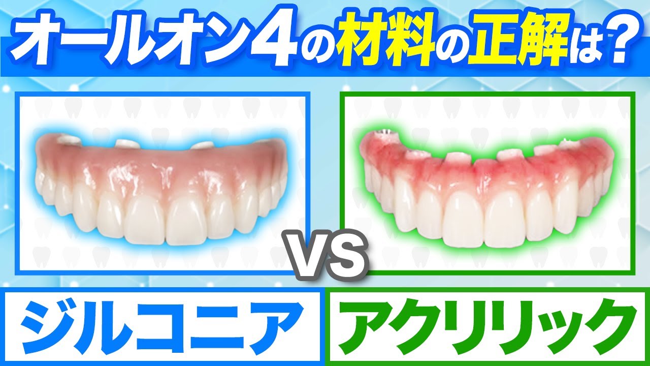 オールオン4で使う材料の正解は？ジルコニア VS アクリリック