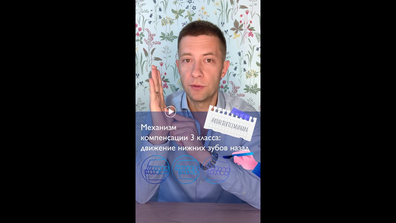 6. Механизм компенсации 3 класса:  движение нижних зубов назад. | #конспектсеминара