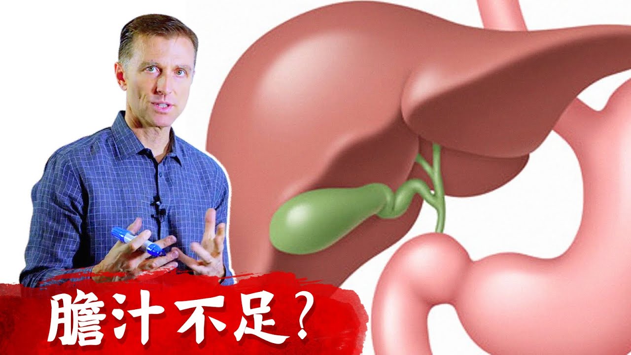 膽汁不足,症狀多: 黃疸,脹氣,便秘,膽結石,憂鬱,脂肪肝.柏格醫生Dr Berg