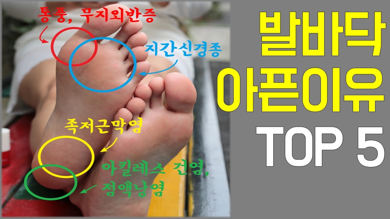 당신의 발바닥통증 원인은?