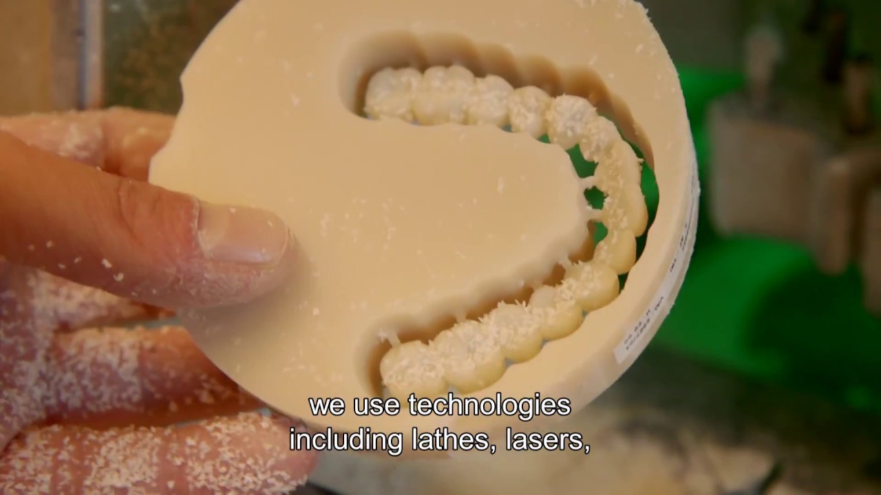 Formlabs Form2 3D printer at Yuli Dental Studio in Israel