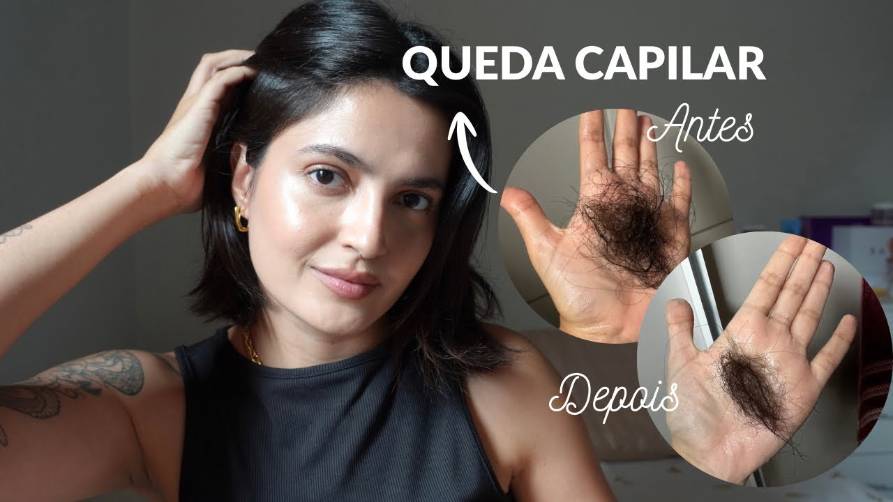 Queda capilar! entenda os motivos e os tratamentos | MEU caso real! 