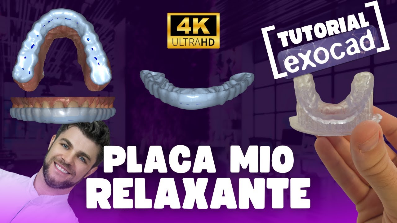 Guia definitivo EXOCAD - PLACA MIORELAXANTE - Como fazer uma goteira perfeita sem ajustes?