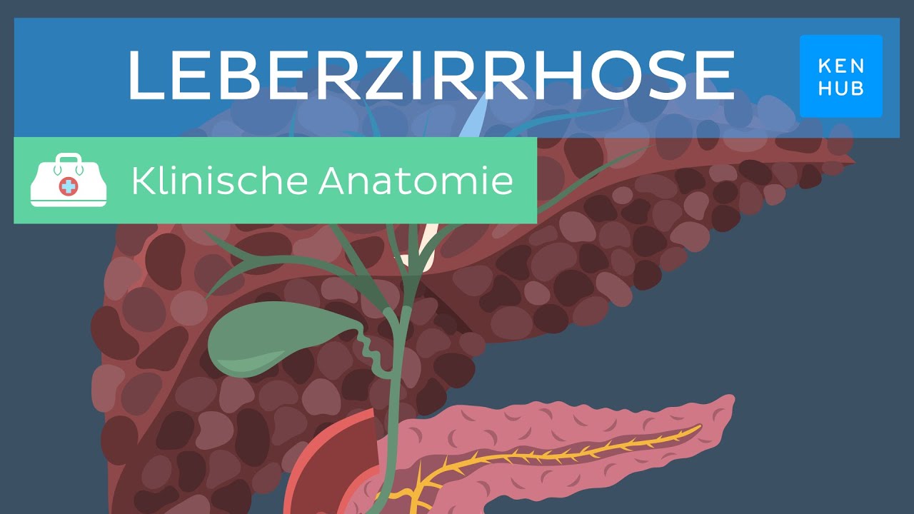 Leberzirrhose: Ursachen, Symptome, Diagnose, Behandlung | Kenhub