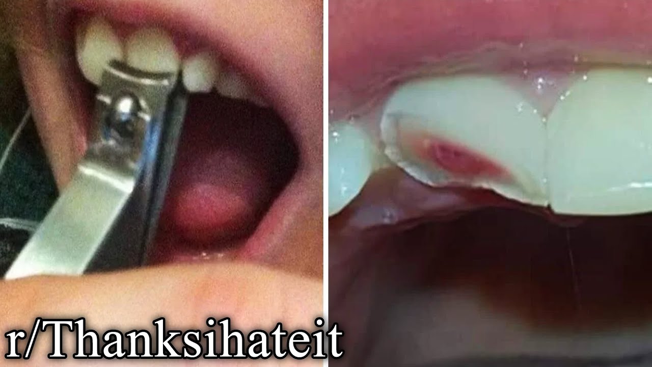 r/TIHI | you'll regret clicking this.