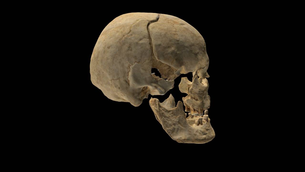 3D model of a skull