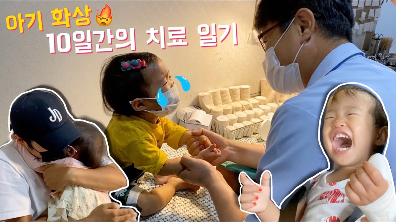 화상 입었을 때? 반드시 알아야 할 응급대처법 🚨제발 이것만은 하지 마세요...🚨