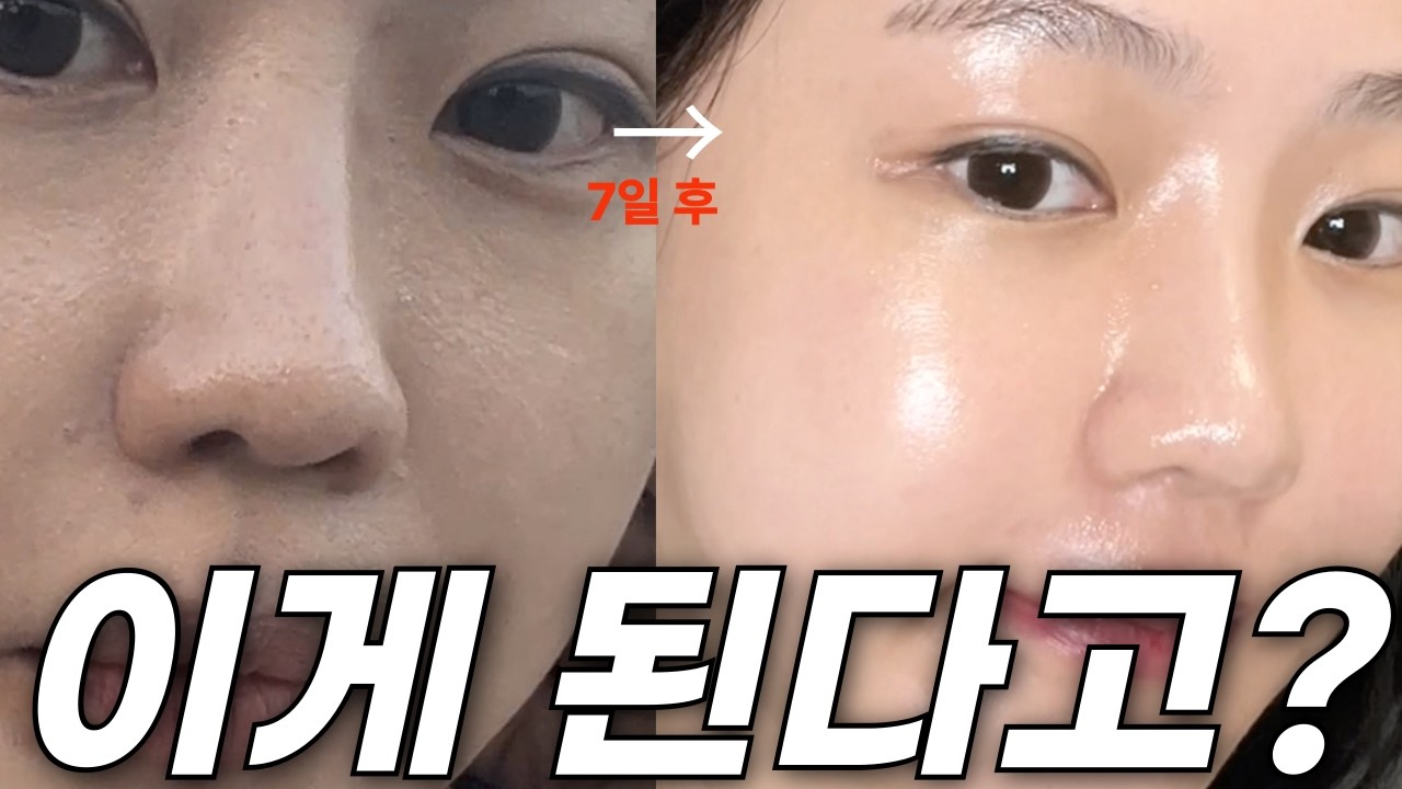 딱 3개만 바꿨더니 일주일 만에 피부 좋아진 스킨케어 루틴