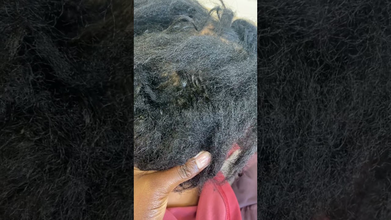 How to detangle Extremely matted hair on Afro hair🤭.