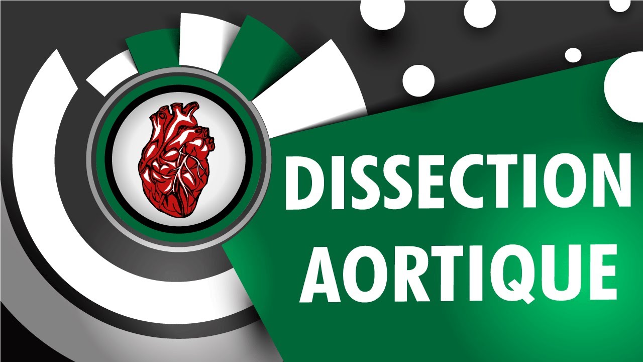 Cardiologie: La Dissection Aortique