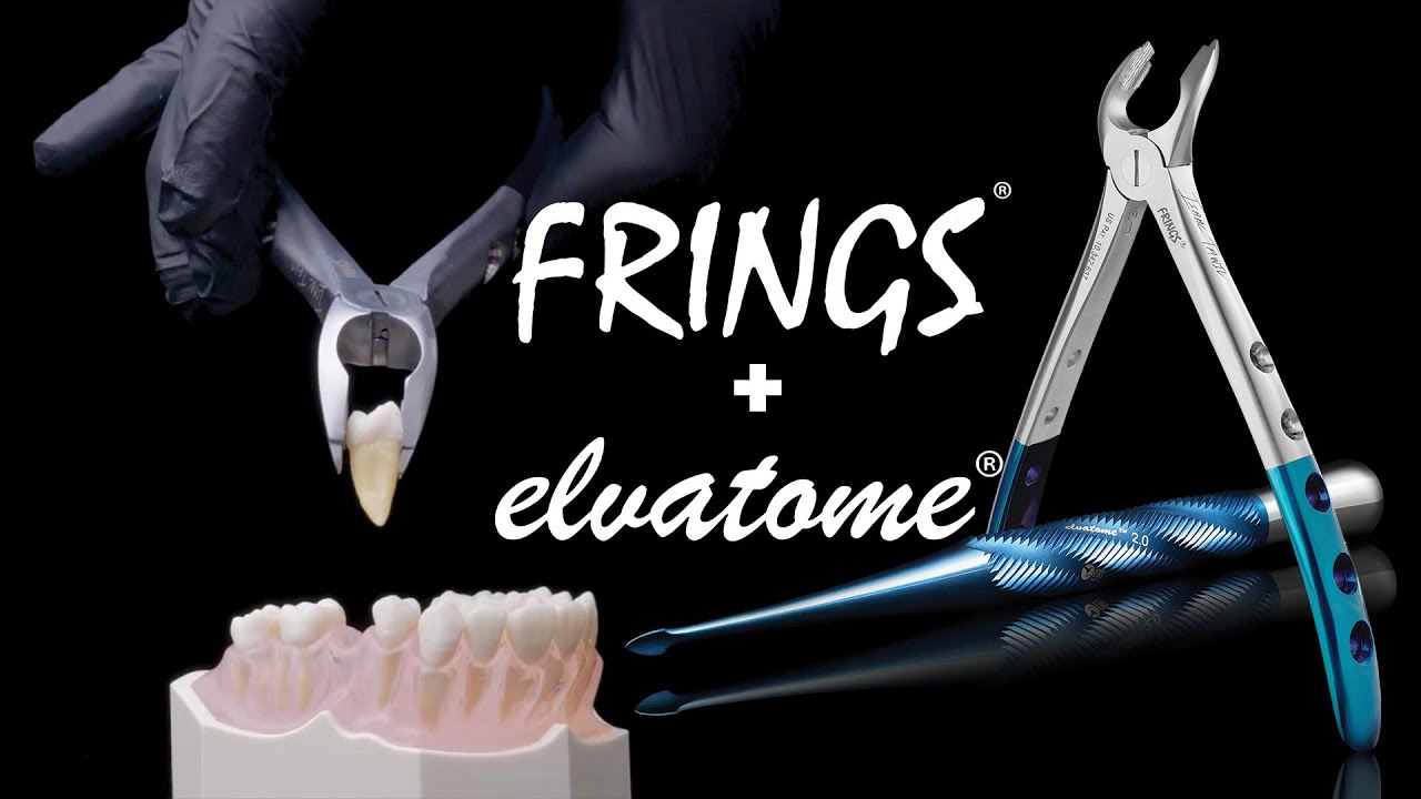 How to use Elvatomes and FRINGS in harmony?