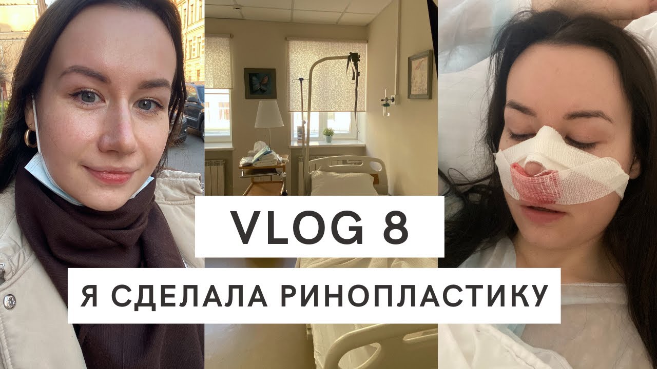VLOG 8 | Я СДЕЛАЛА РИНОПЛАСТИКУ
