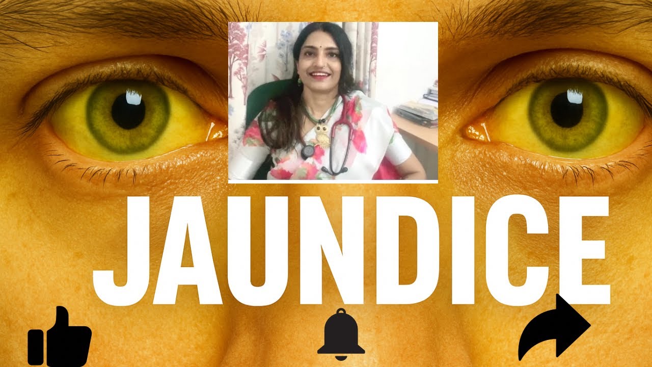 Jaundice - causes, treatment & pathology #video #shortvideo #youtubevideo #viralvideo #jaundice