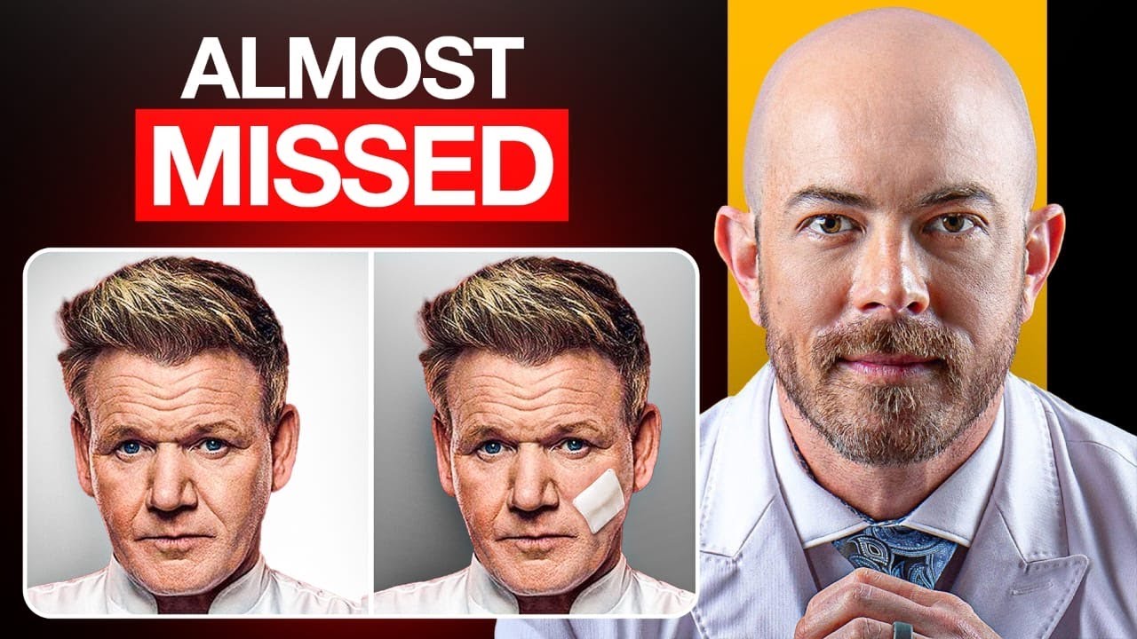 Doctor Reacts to Gordon Ramsay's Skin Cancer Treatment