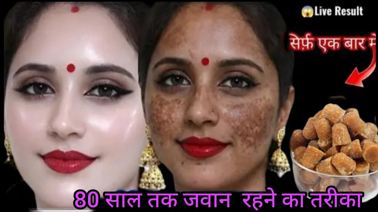 दो बूंद लगते ही मेरा चेहरा शीशे की तरह चमकने लगा👉10 साल पुरानी झाइयां काले दाग धब्बे सब साफ हो गए🙈