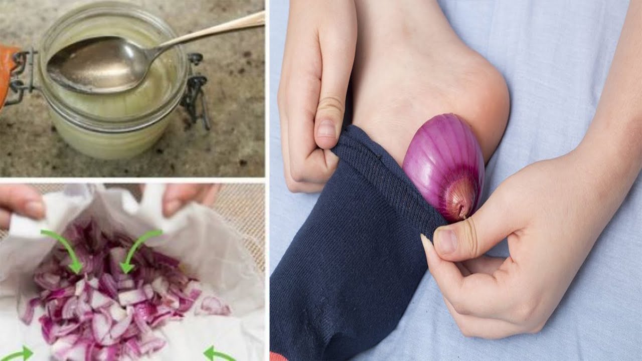 Qepë me kripë, receta që kuron problemet tuaja më të mëdha