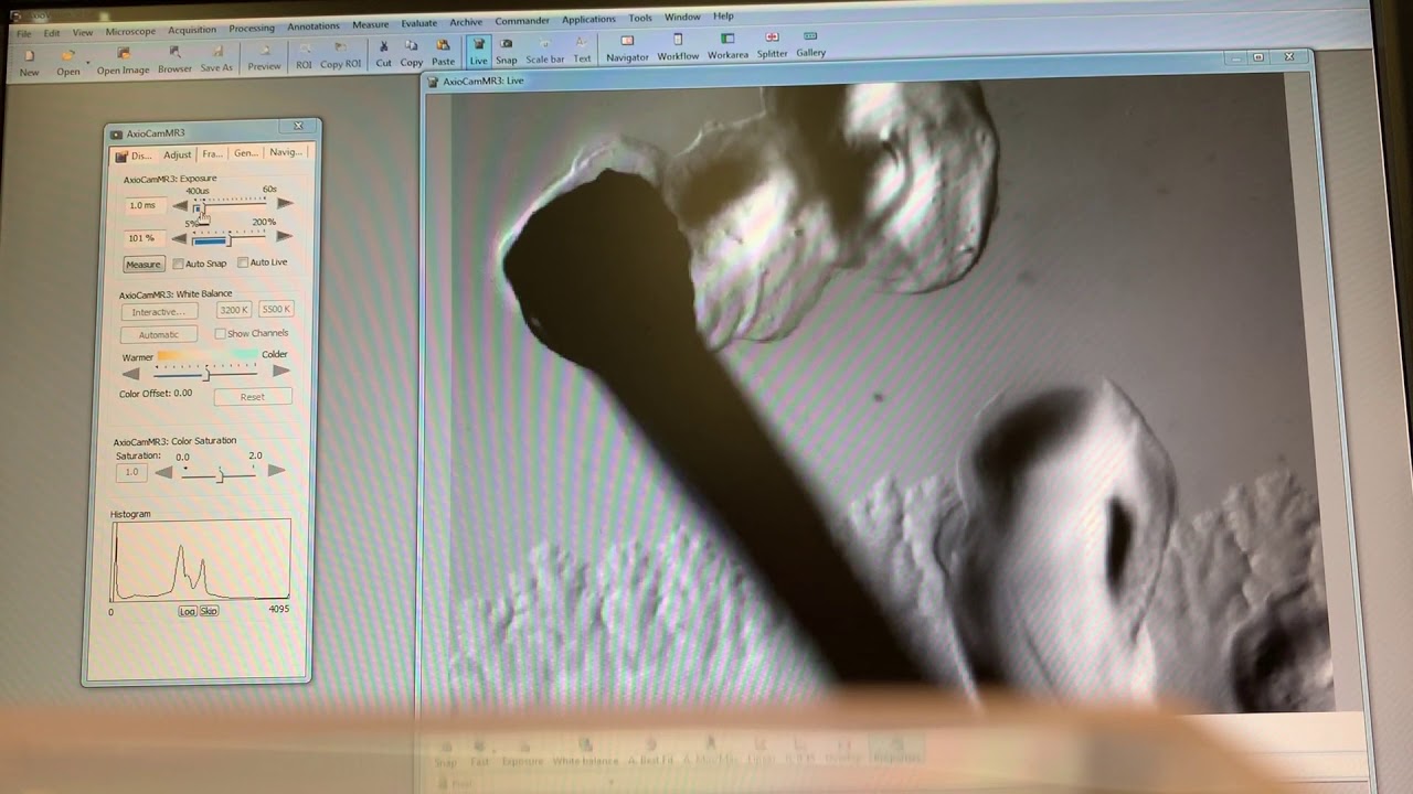 собирание червей