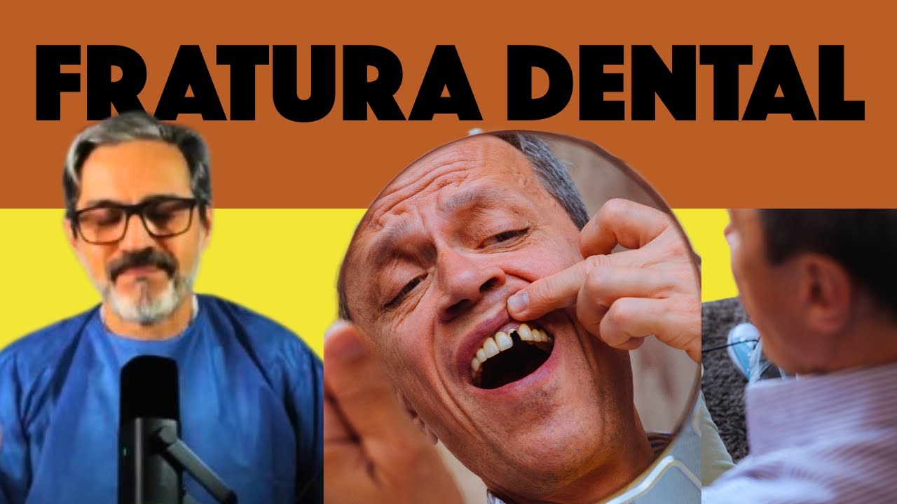 DENTE QUEBROU: Salvar ou Extrair? O Método Definitivo para Emergência Odontológica | Dr Douglas Lima