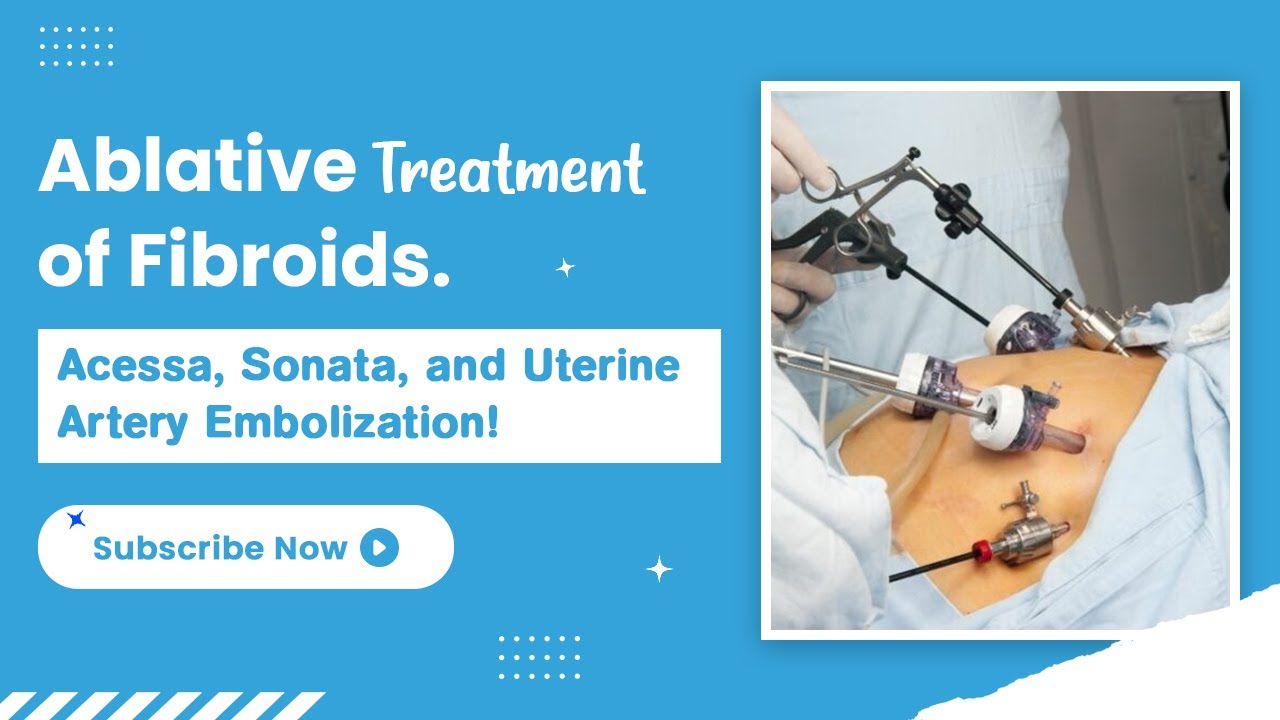 Ablative Treatment of Fibroids! ACESSA, Sonata, and Uterine Artery Embolization! - TheFibroidDoc