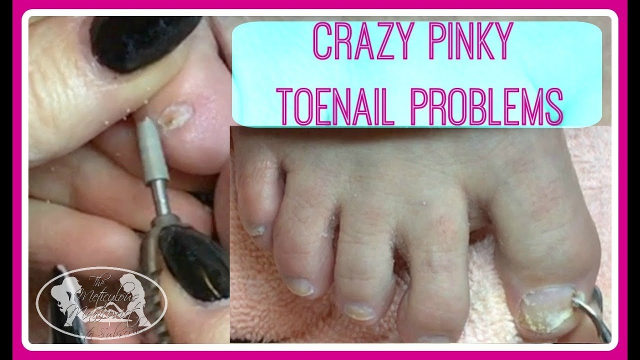 Crazy Pinky Toenails Pedicure Tutorial + Giveaway Opportunity!