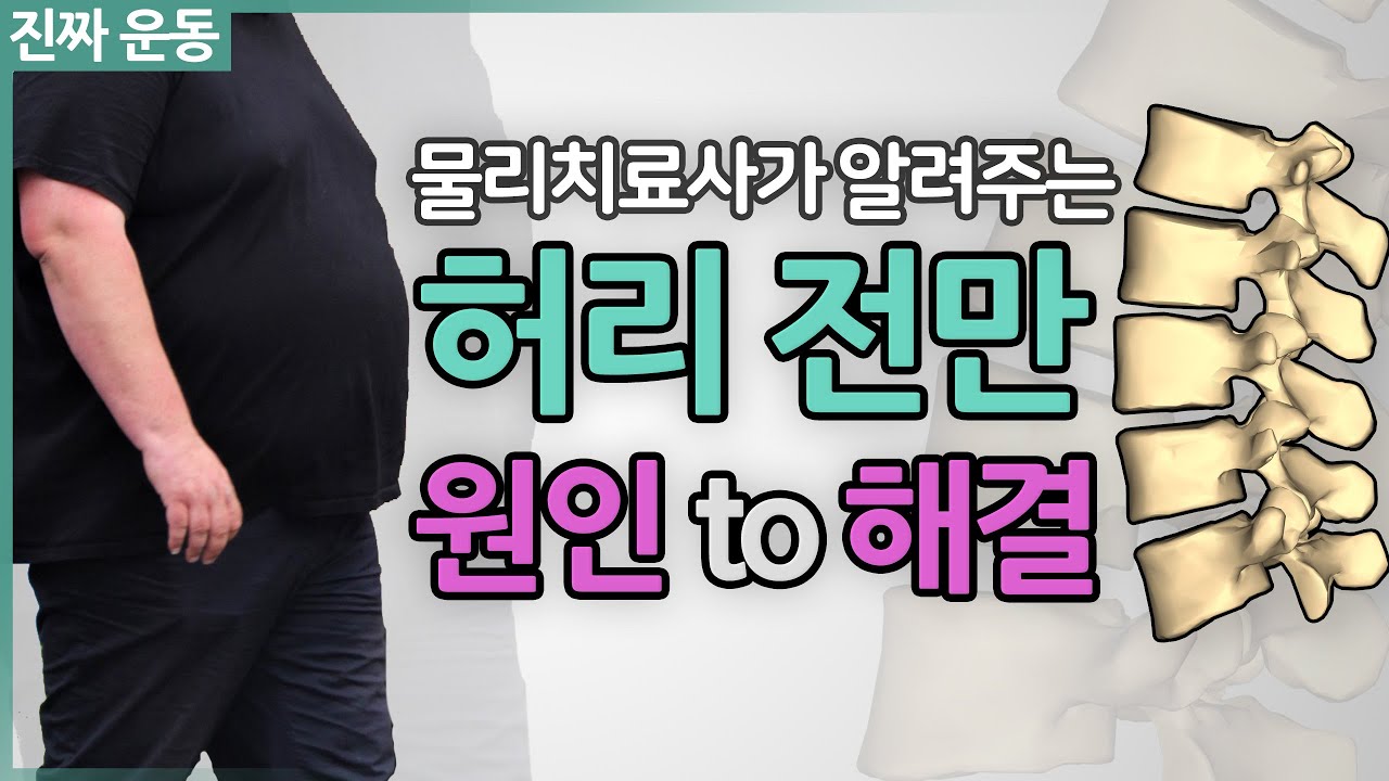 배가 나오고 허리가 아프다면? [허리전만 체형 교정] 원인부터 해결까지!