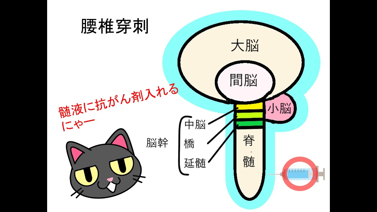 必見‼白血病　骨髄穿刺？腰椎穿刺？